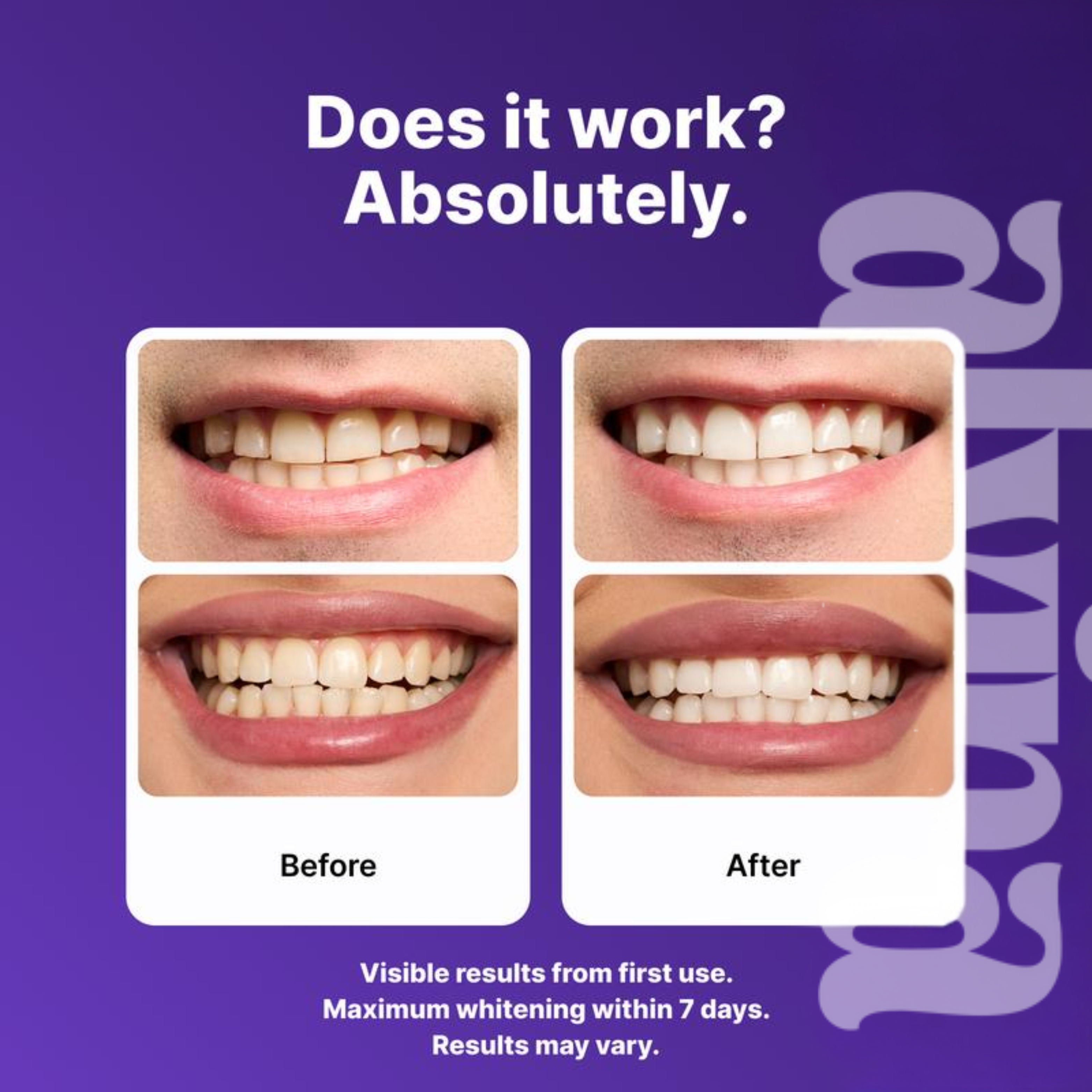 Alvina - Whitening Strips