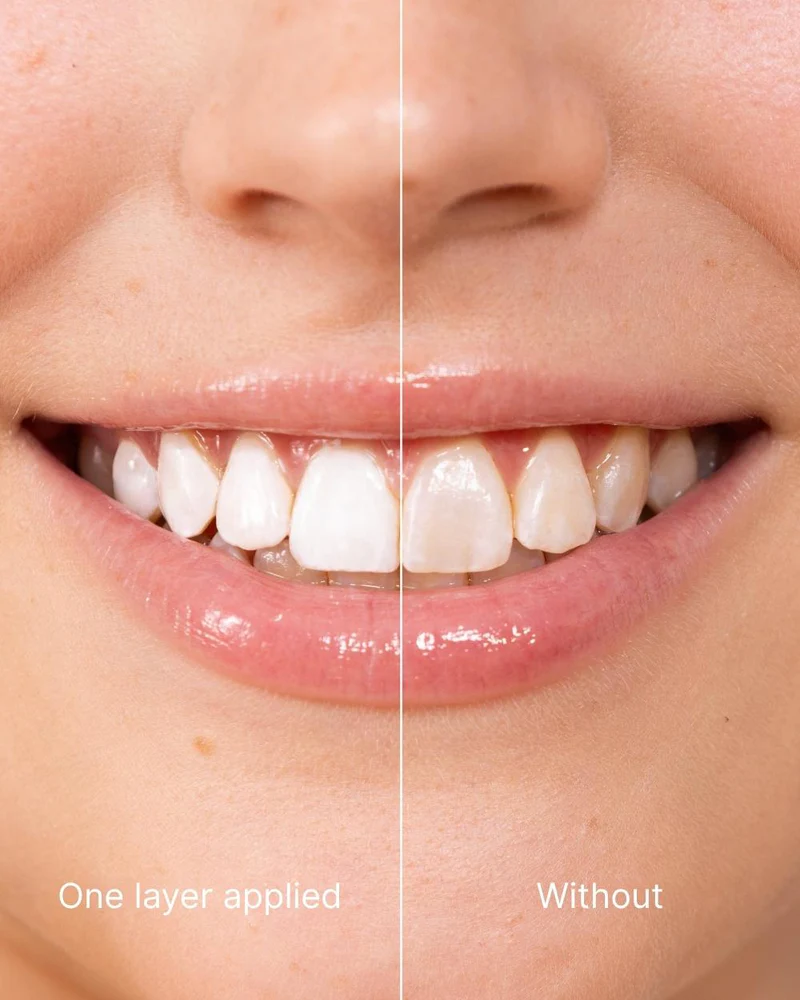 Teeth Whitening Polish